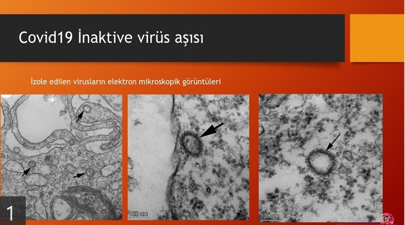Ercüment Ovalı bakanlığa raporunu sundu...