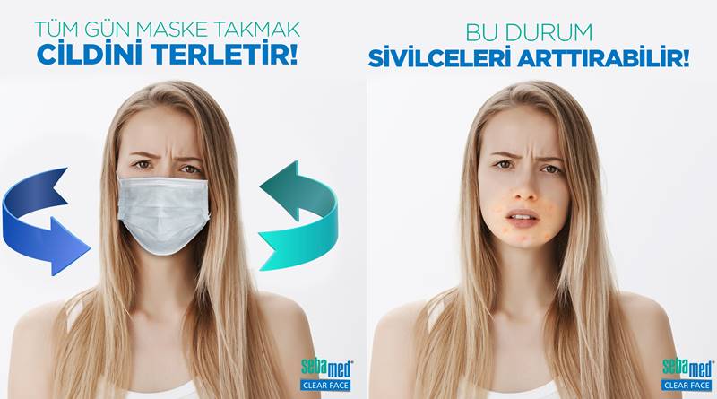 Okula Dönüşte Maskenin Yol Açtığı Sivilce Sorununu Kafanıza Takmayın