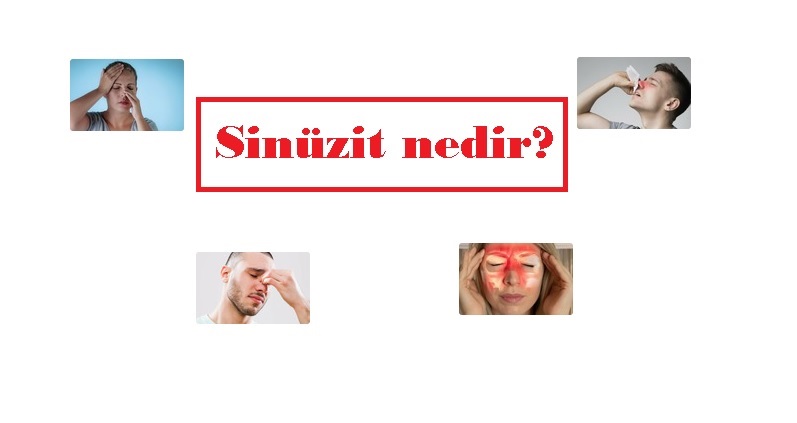 Islak saçla dışarı çıkmak Sinüzite neden olur mu? Avrasya - KBB Uzmanı Op. Dr. Cengiz açıkladı!