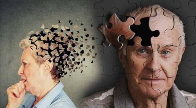 Demans ve Alzheimer Arasındaki Farklar Nelerdir?
