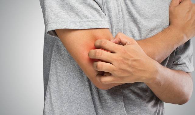 Mantar hastalığı hakkında bilinmesi gereken 6 önemli bilgi!